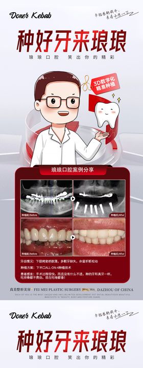 种植牙集采活动案例海报