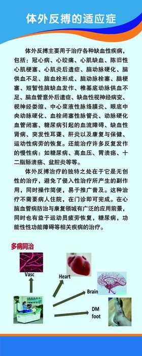 体外反搏的适应症易拉宝展架