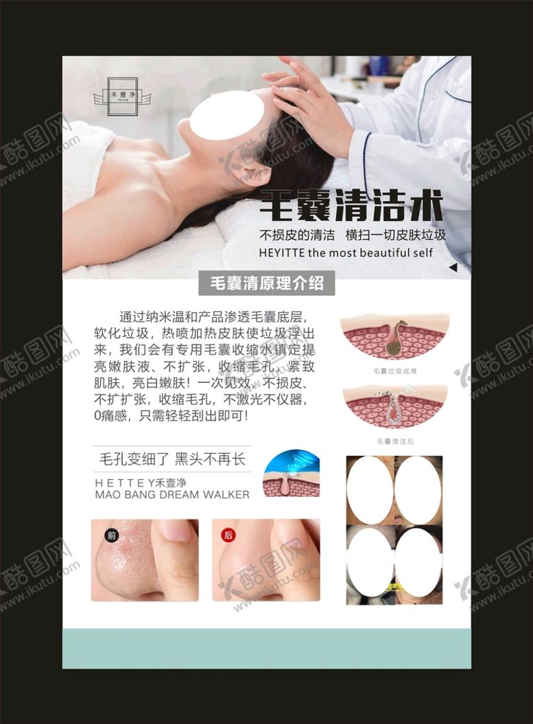 编号：87720810231829023813【酷图网】源文件下载-毛囊清洁术 宣传单
