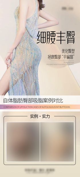 医美细腰丰臀海报