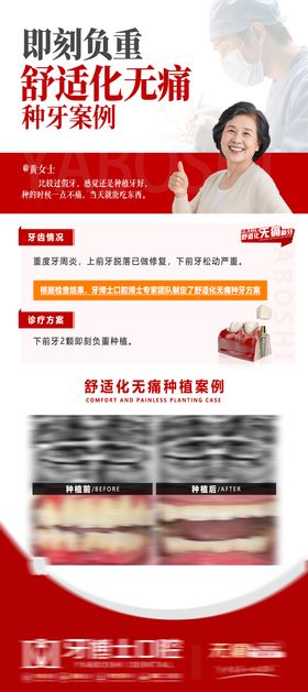 舒适化口腔诊疗种牙海报