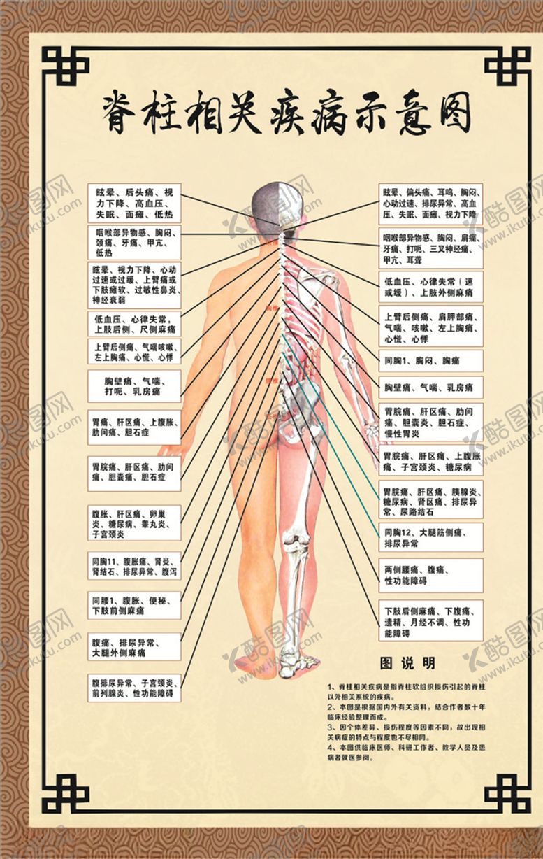 编号：83671609260629184719【酷图网】源文件下载-脊柱相关疾病示意图