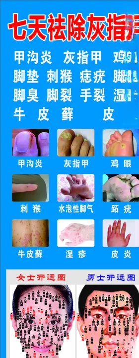 七天祛除灰指甲男女开运图