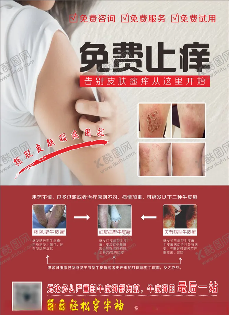 编号：61823605091809305679【酷图网】源文件下载-牛皮癣