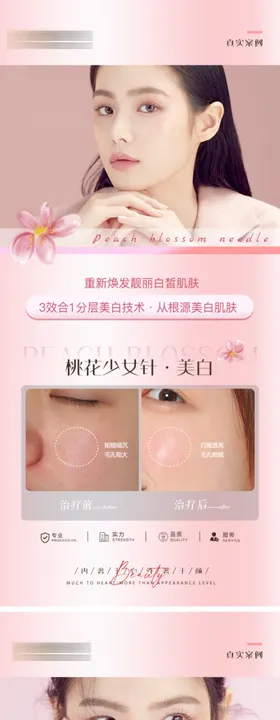 医美案例效果对比图