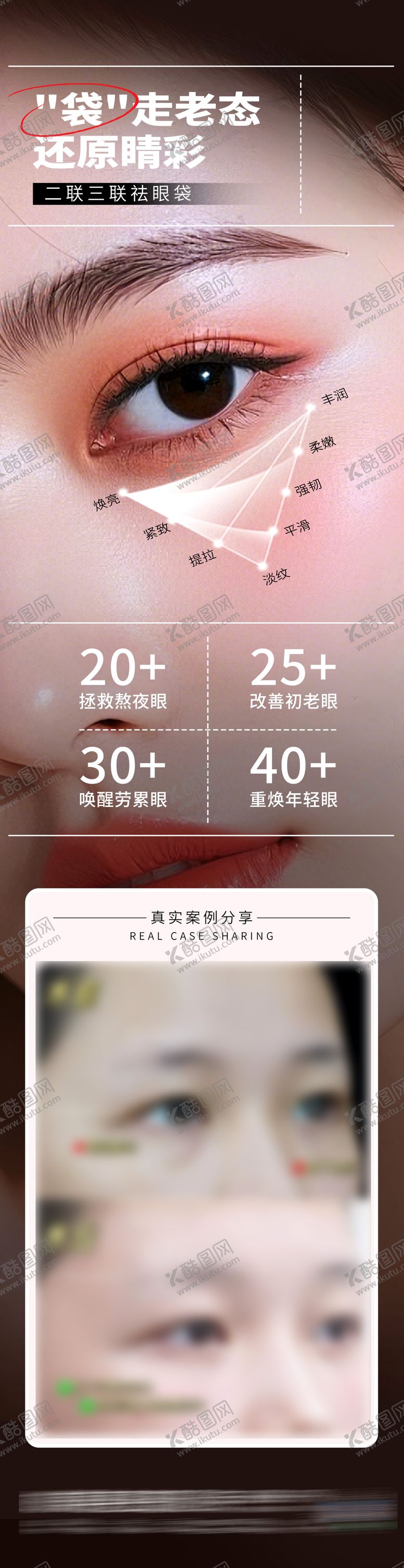 编号：54159010050402512217【酷图网】源文件下载-医美二联三联祛眼袋年轻化案例创意海报