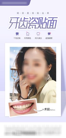 口腔美学牙齿贴面海报