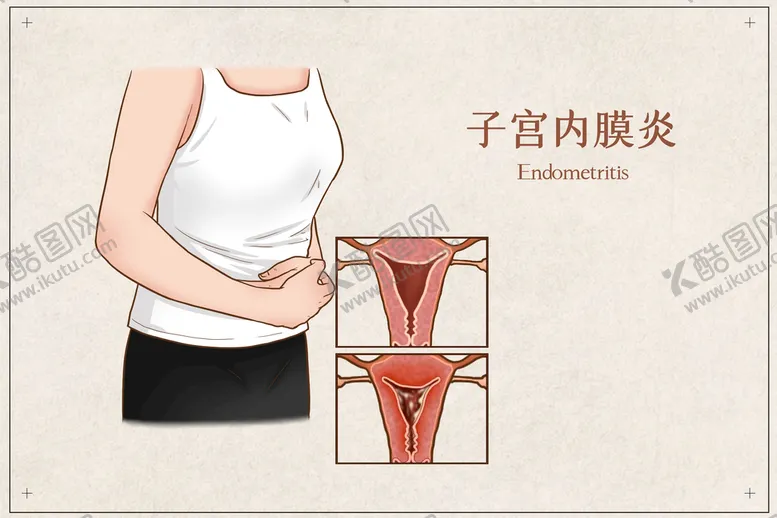 编号：29924611011503366861【酷图网】源文件下载-子宫内膜炎