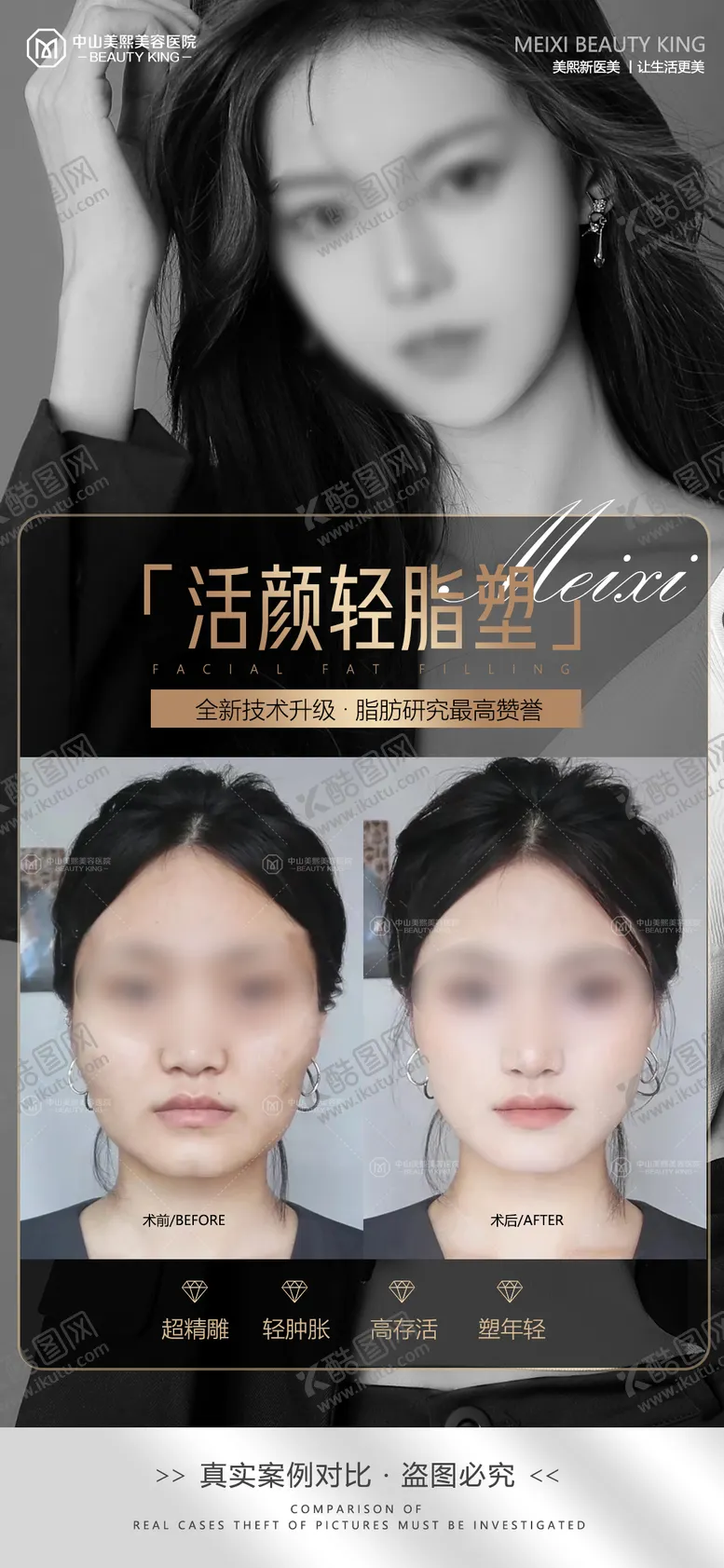 编号：68280811210613051156【酷图网】源文件下载-医美脸部填充案例海报