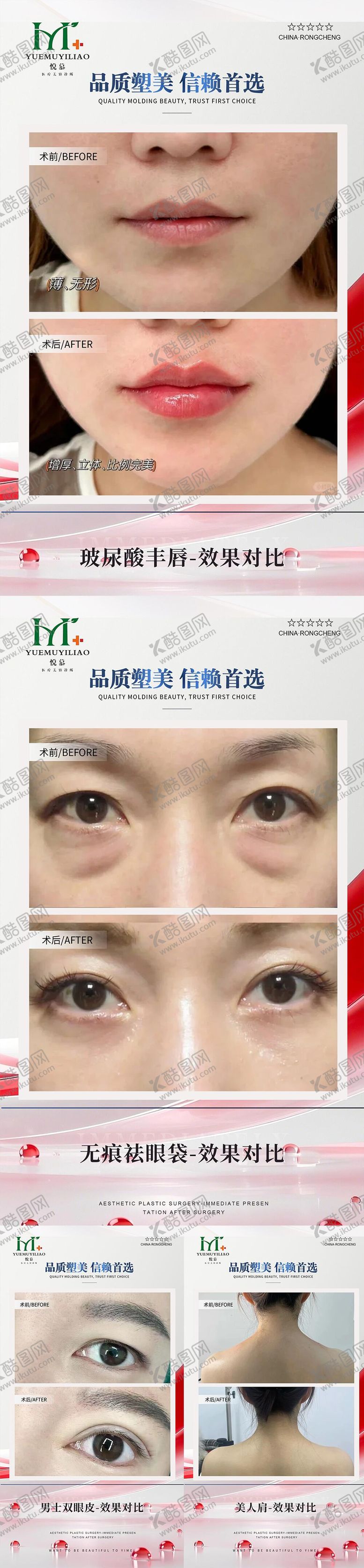 编号：81919811171237066297【酷图网】源文件下载-医美案例