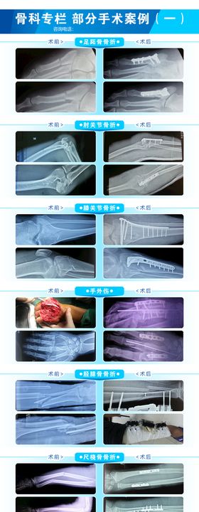 骨科部分手术项目案例展示