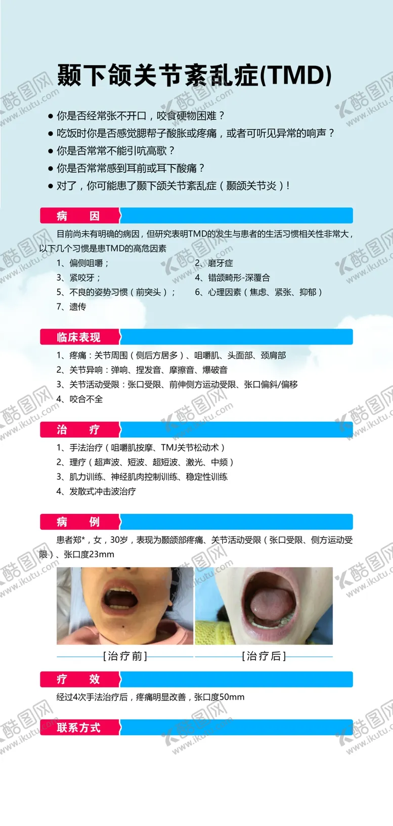 编号：49928807021732599506【酷图网】源文件下载-颞下颌关节紊乱症TMD