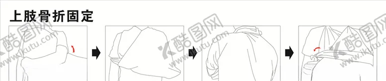 编号：24160805031218569934【酷图网】源文件下载-上肢骨折固定手绘步骤