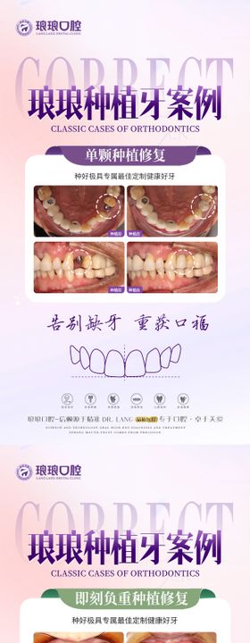 种植口腔专家案例海报长图