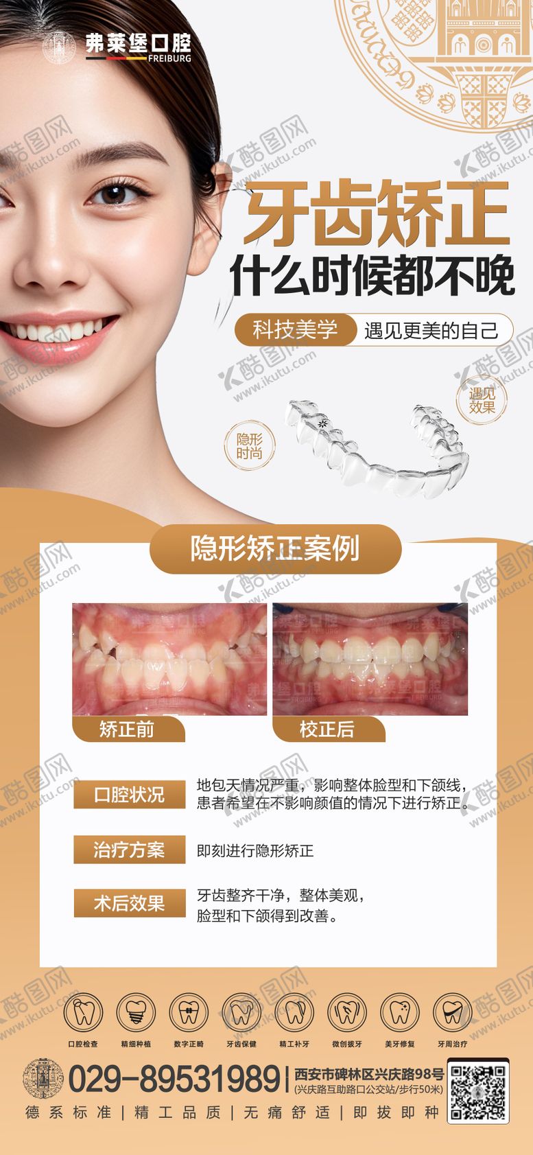 编号：24445705030635285488【酷图网】源文件下载-牙齿矫正