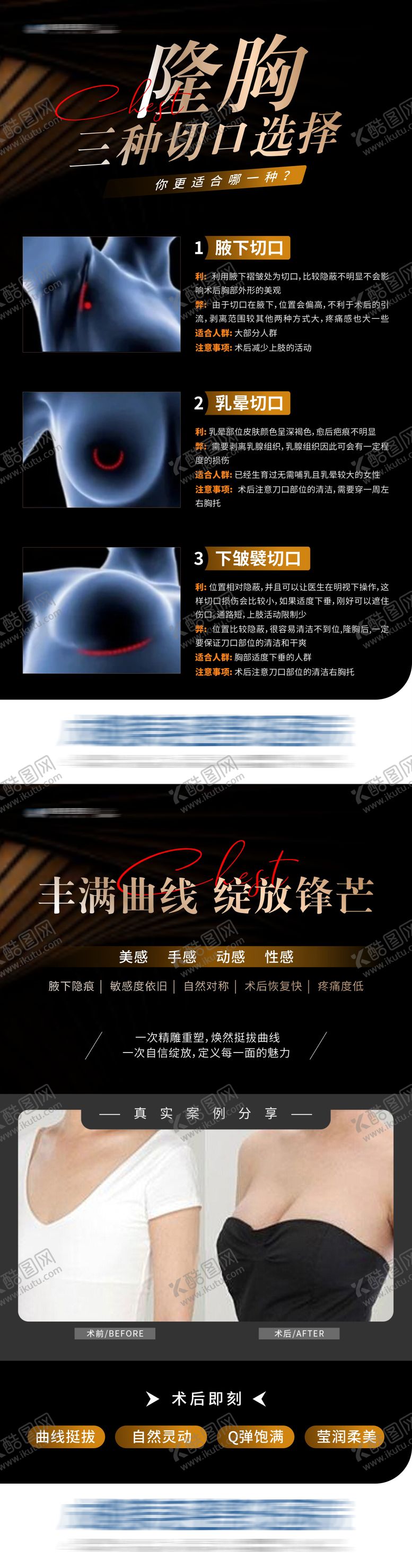 编号：40618612300942373475【酷图网】源文件下载-医美隆胸丰胸三种切口科普案例创意海报