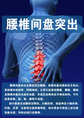 腰间盘突出三折页