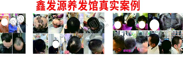 编号：39723807080013584658【酷图网】源文件下载-养发馆