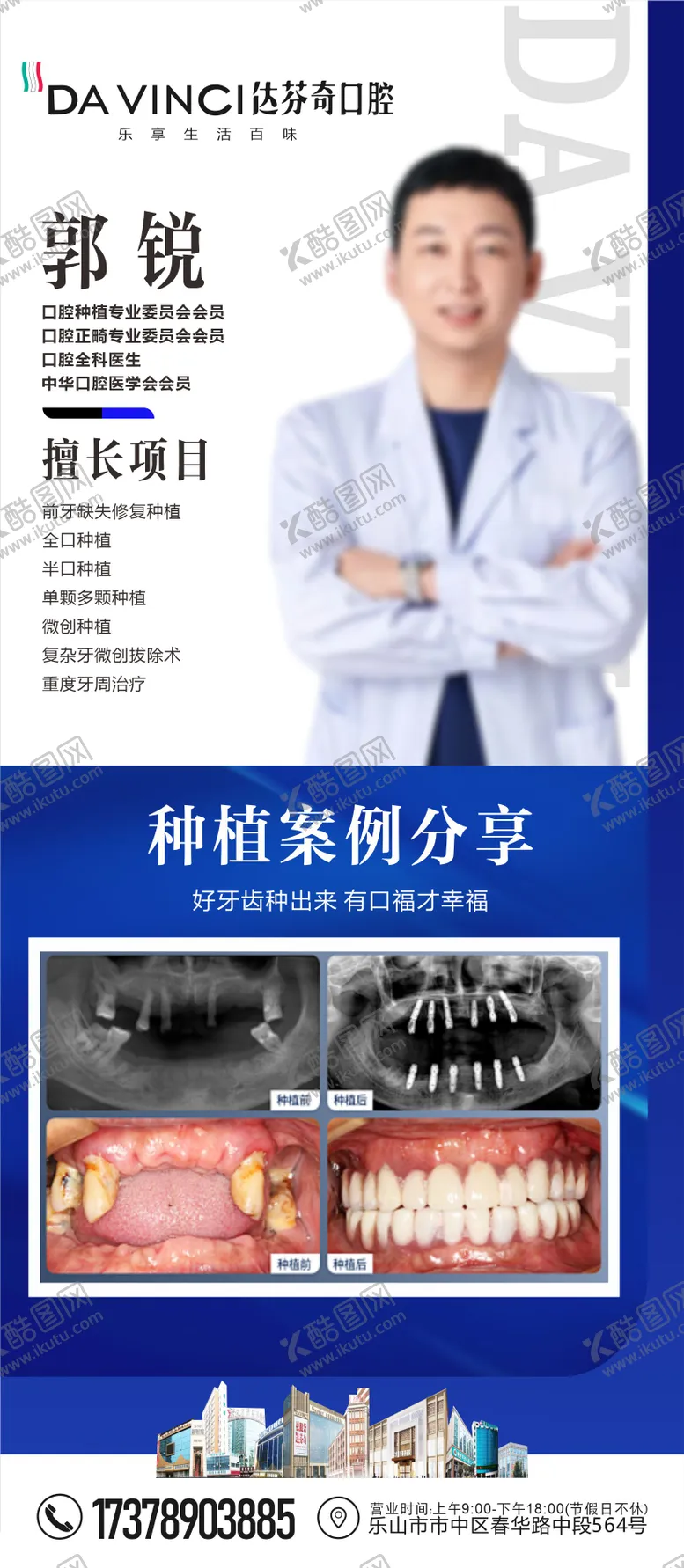 编号：25677007021433447667【酷图网】源文件下载-口腔医生专家介绍种植案例海报