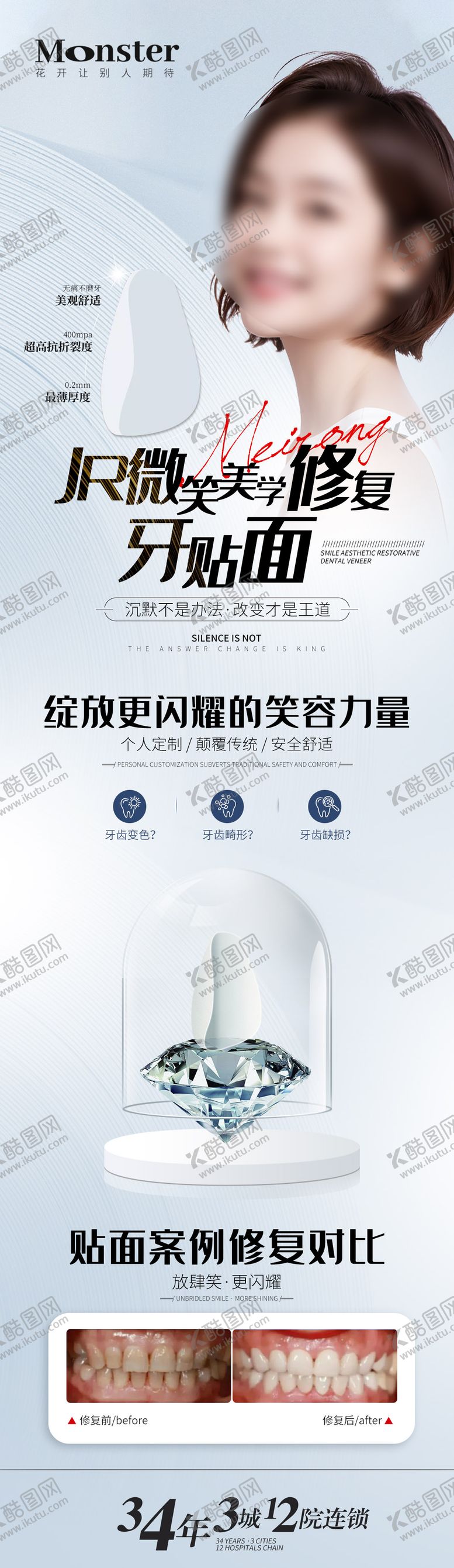 编号：20742010311747443512【酷图网】源文件下载-医美牙贴面长图