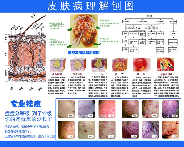 编号：86899910242249214307【酷图网】源文件下载-皮肤病理图