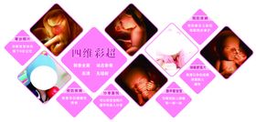 四维彩超