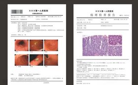 病理报告