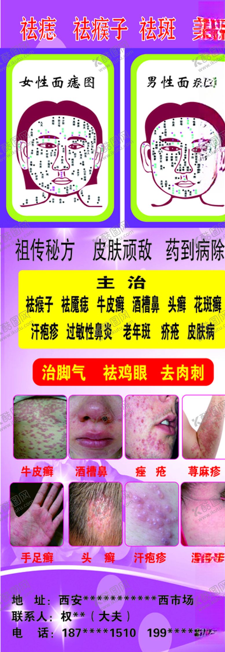 编号：50115909211039263303【酷图网】源文件下载-祛痣展架