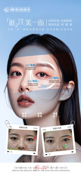 医美眼周抗衰宣传对比海报