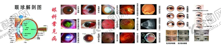 编号：64516806290019129963【酷图网】源文件下载-常见眼科病
