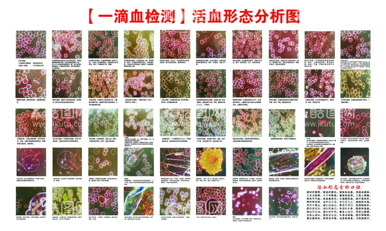 编号：72306510020620463470【酷图网】源文件下载-一滴血检测