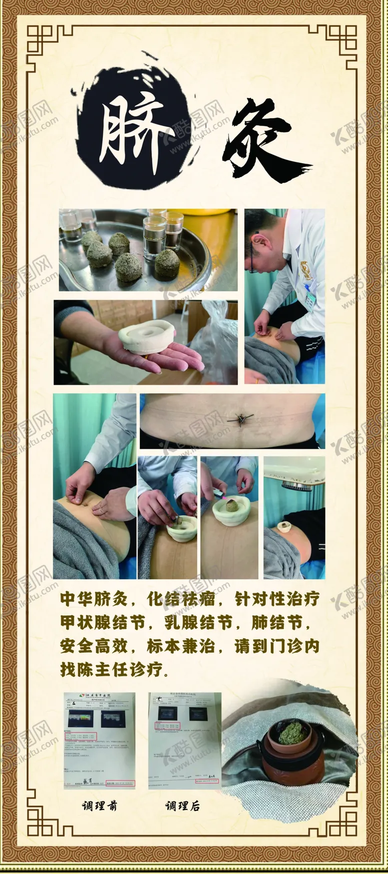 编号：68791502260827196249【酷图网】源文件下载-脐灸易拉宝