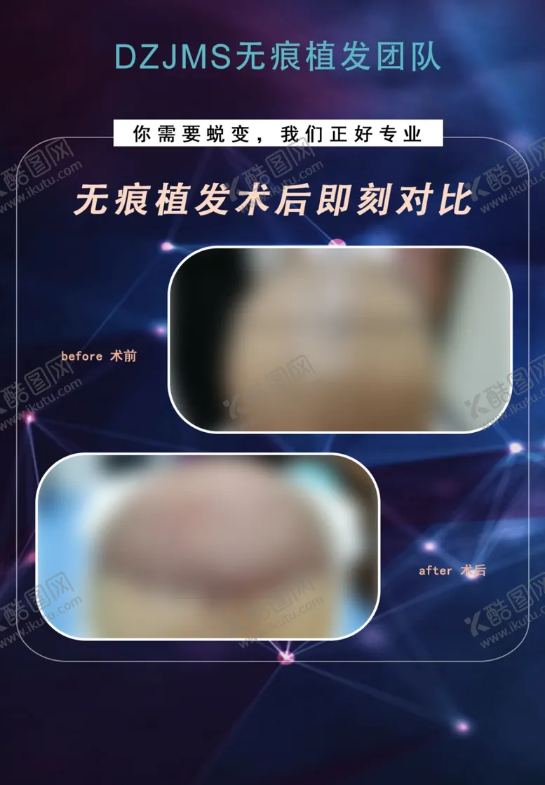编号：10751304282300171599【酷图网】源文件下载-植发
