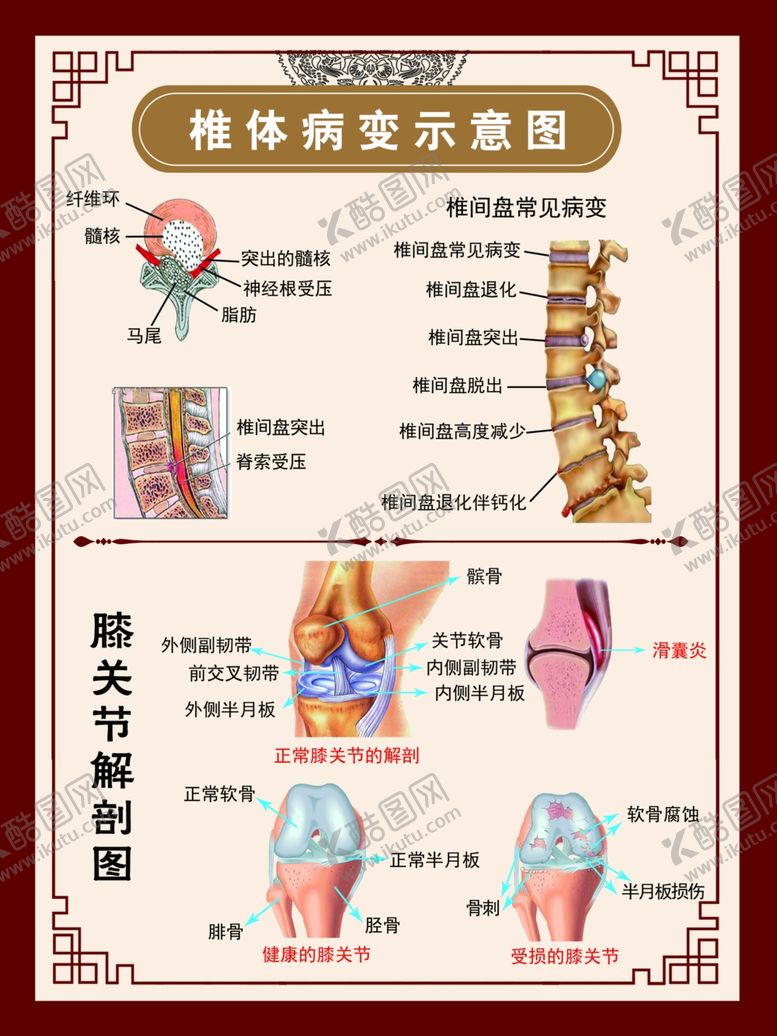 编号：22942901291740537170【酷图网】源文件下载-椎体病变示意图