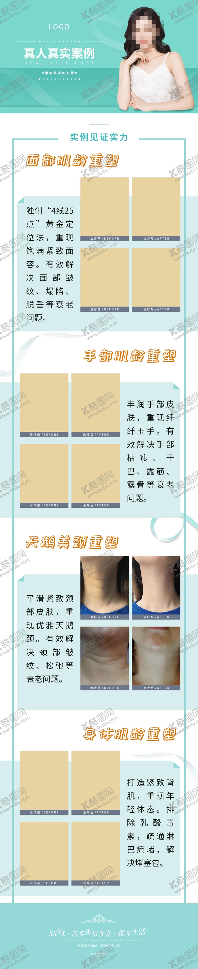 编号：85912309150022409586【酷图网】源文件下载-真人真实案例详情长图