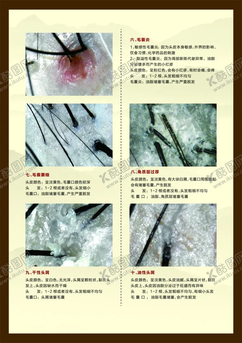 编号：47642809181722432354【酷图网】源文件下载-发质毛囊对比分析