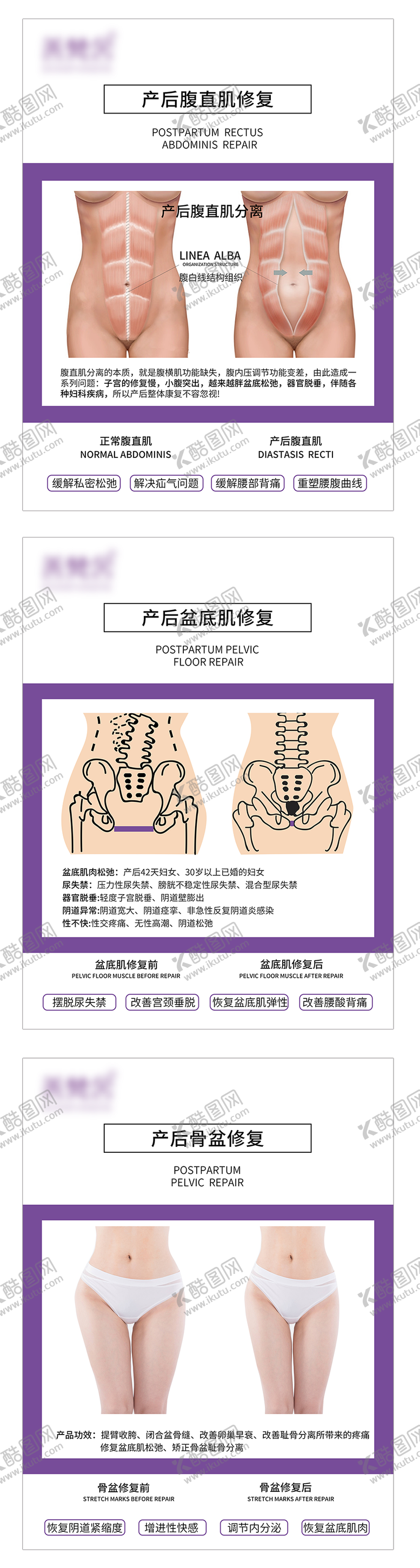 编号：45501511170332149311【酷图网】源文件下载-产后系列对比图海报