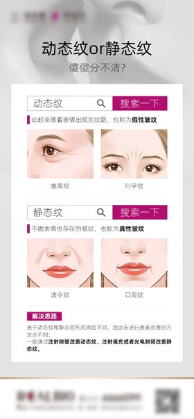 医美动态纹静态纹科普海报