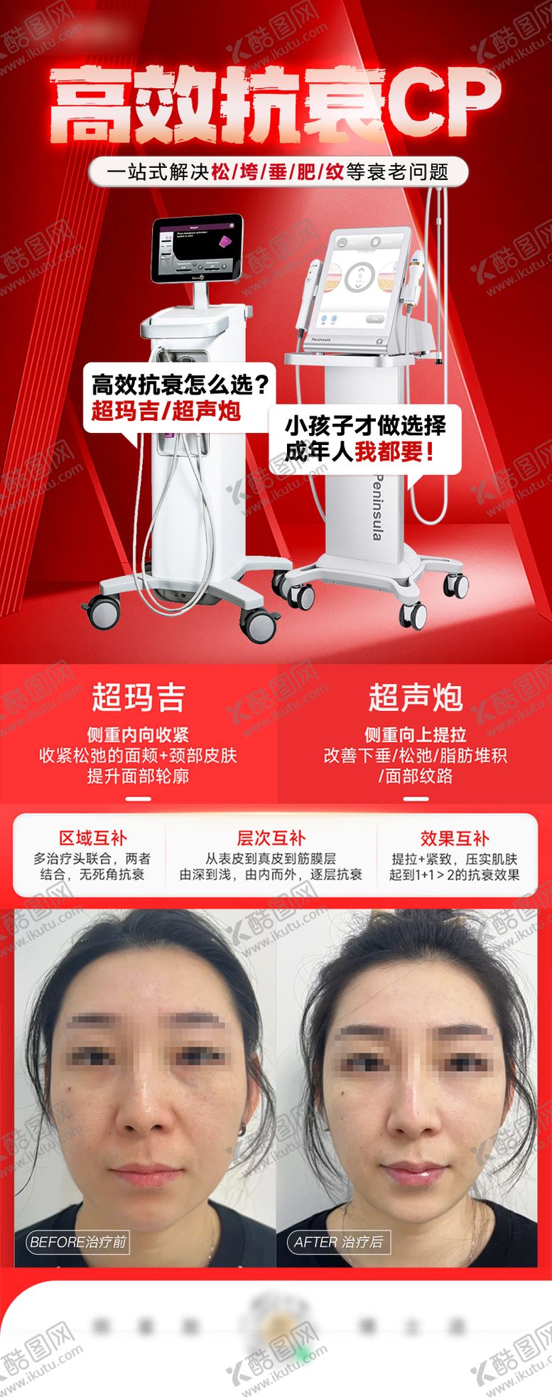 编号：27951910020018137360【酷图网】源文件下载-医美超玛吉 超声炮案例海报