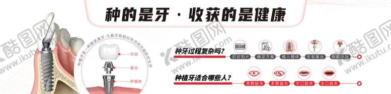 编号：71119203091420349275【酷图网】源文件下载-口腔种植牙海报展架