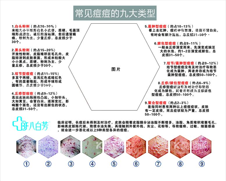 编号：79503410080433206827【酷图网】源文件下载-八白芳常见痘痘的九大类型