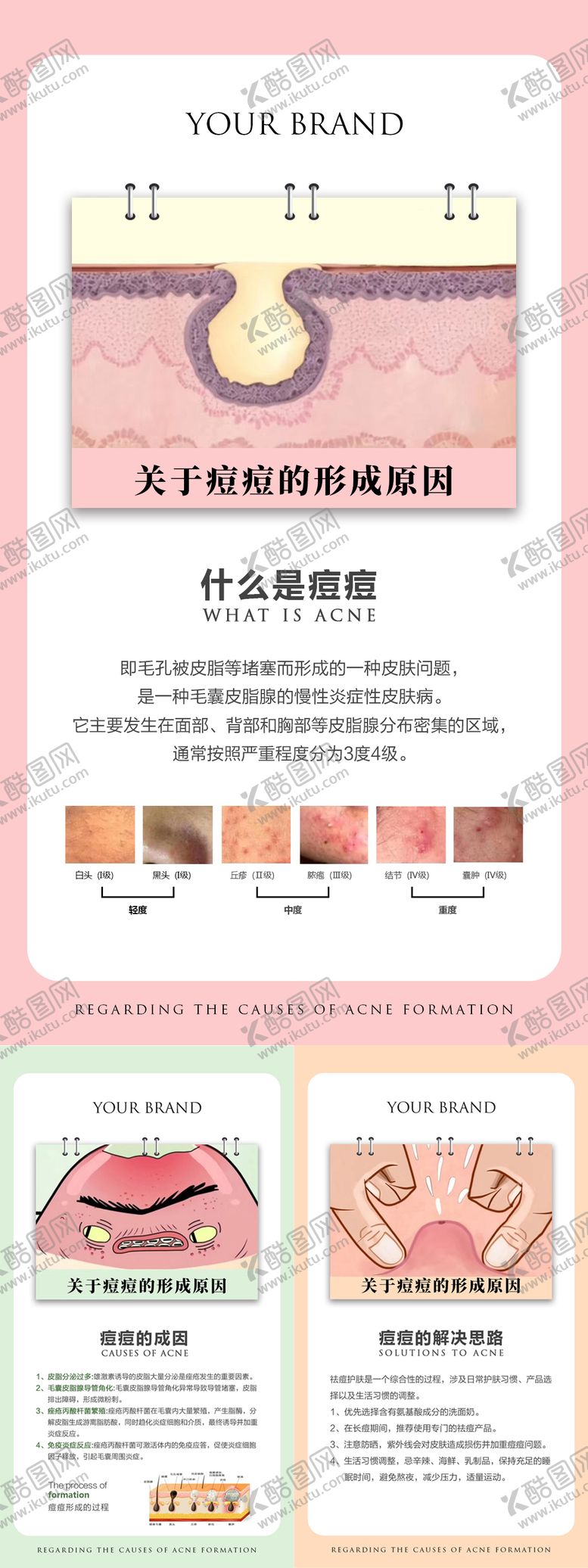 编号：56124311281548425169【酷图网】源文件下载-痘痘的形成原因海报