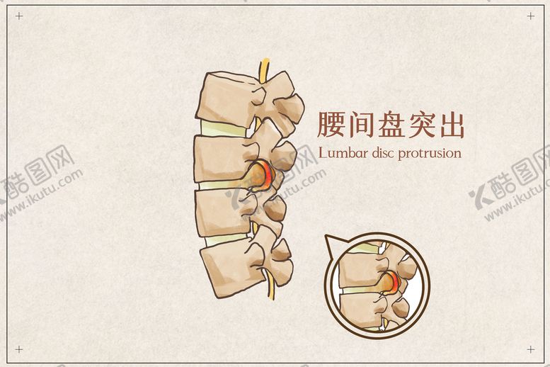 编号：25637409290212194285【酷图网】源文件下载-腰间盘突出
