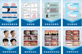 口腔医院正畸科科普展板