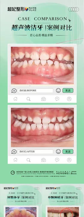 口腔案例对比海报