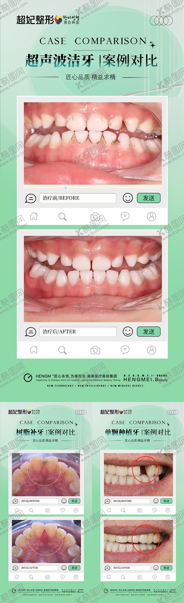 编号：67363103051359214151【酷图网】源文件下载-口腔案例对比海报