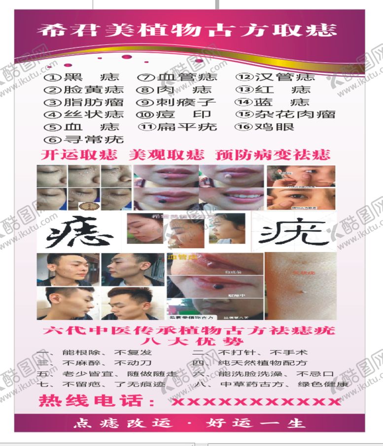 编号：51390110230454595394【酷图网】源文件下载-祛斑 祛痣 美容海报