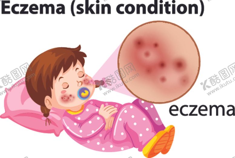 编号：80821709291342246682【酷图网】源文件下载-卡通儿童和皮炎