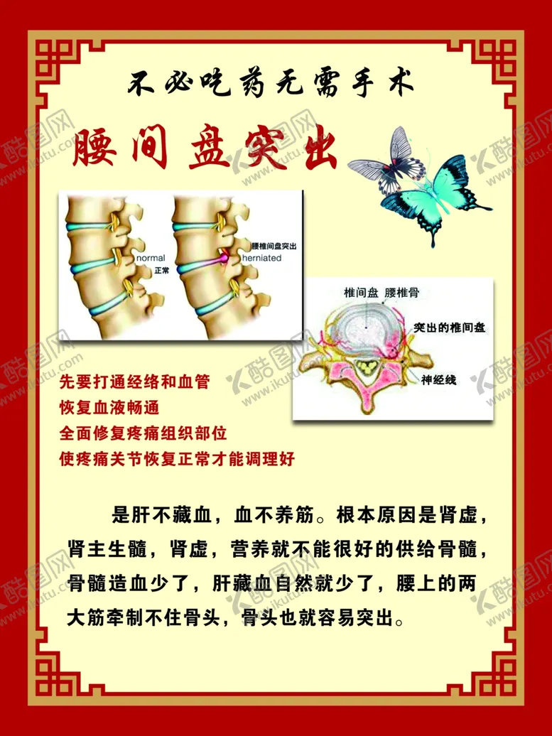 编号：86193502091715576292【酷图网】源文件下载-腰间盘突出
