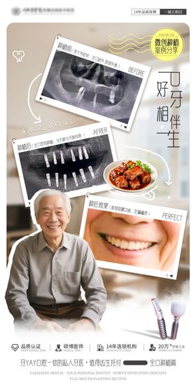 口腔种植案例海报